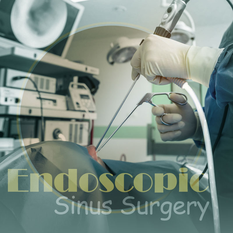 Endoscopic sinus surgery